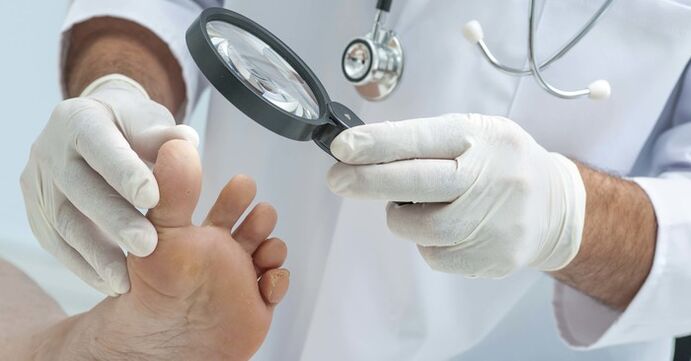 Exame diagnóstico das unhas dos pés