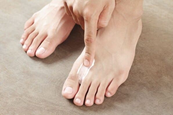 aplicação de pomada do fungo da pele nas pernas